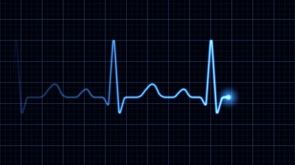 Electrocardiogram on a blue screen