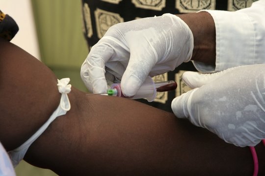 アフリカでのエイズ検査