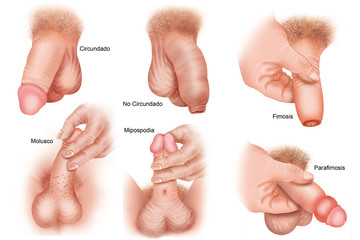 venereal diseases