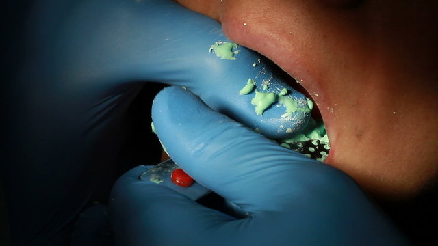 A closeup of a dental imprint