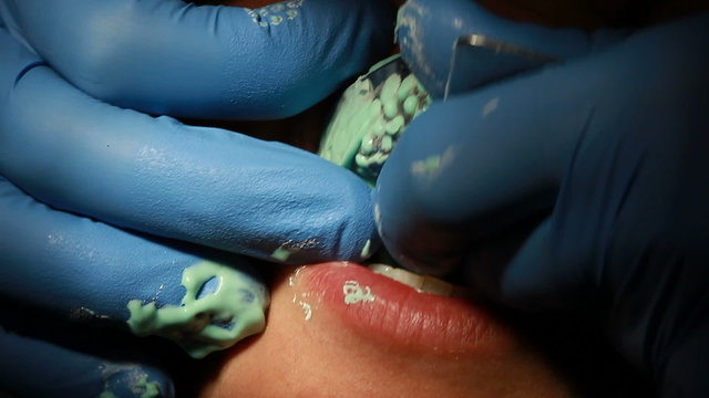 A closeup of a dental imprint