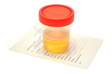 analysis of urine