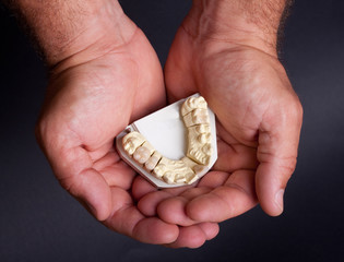dental wax model