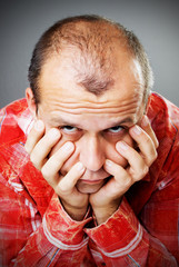 Adult man losing hair