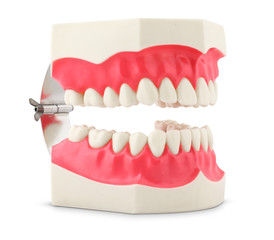 Dental model of teeth