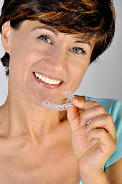 donna denti bite ortodonzia paziente