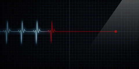 Heart Monitor Flat Line Death