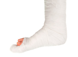 leg in a plaster cast