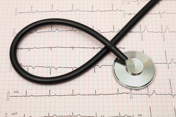 stethoscope on cardiogram