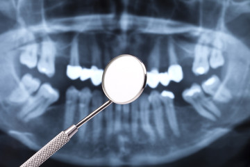 Dentalspiegel