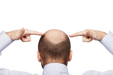 Bald man head