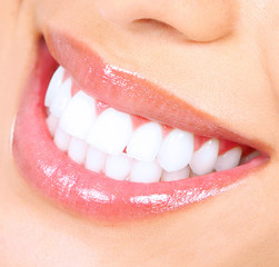 Teeth whitening. Woman smile.