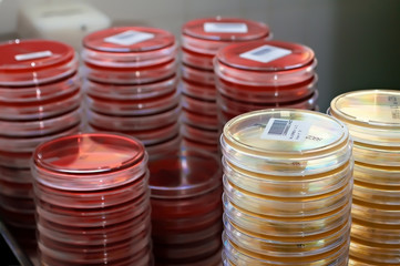Placas con medios de cultivo
