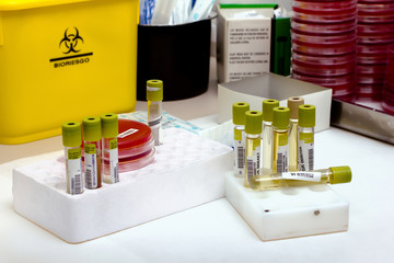 Mesa de trabajo de un laboratorio con tubos y placas
