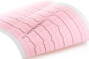 Cardiogram. Macro of ECG graph