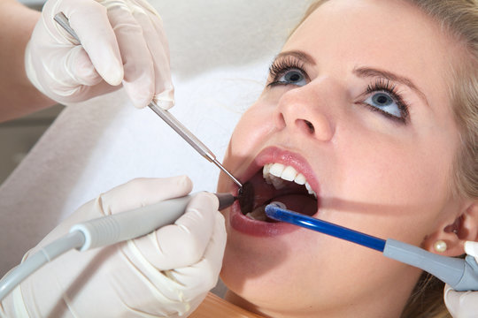 Frau Gesicht bei Zahnarzt Behandlung Nahaufnahme