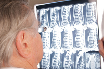 Arzt mit Röntgenbild