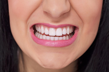 Showing teeth