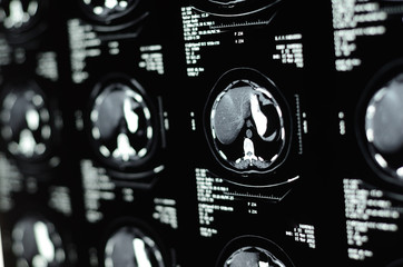 MRI Scan Of Human Abdomen