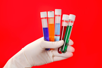 Medical test tubes with fluid sample closeup in gloved hand on r