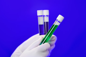 Medical test tubes with fluid sample closeup in gloved hand on b