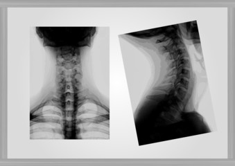 X-ray of neck vector background