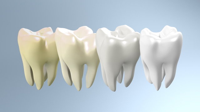 Process Of Yellow Tooth To White