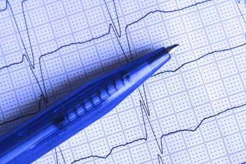 Ballpoint pen on the ECG surface