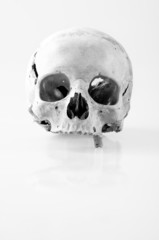 Human skull with only one tooth in black and white