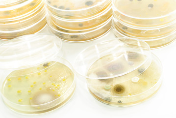 Macro mold and bacterai colonies growing on an agar plates.