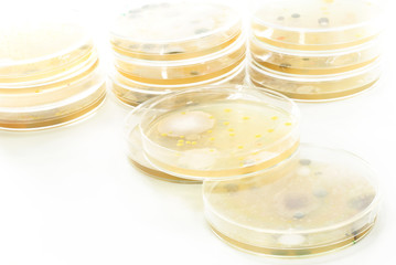 Macro mold and bacterai colonies growing on an agar plates.