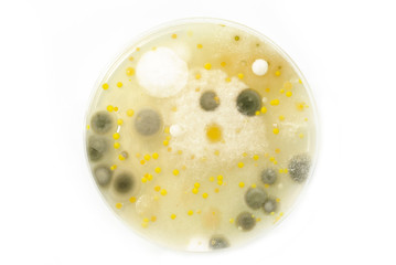 Macro mold and bacterai colonies growing on an agar plates.