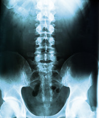 human body on x-ray