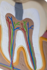 Tooth