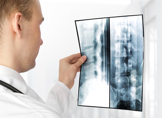 Rear view of young male doctor examining a xray