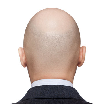 Bald man head