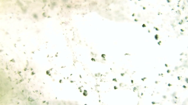 Particles in liquid environment