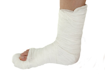 leg in a plaster cast