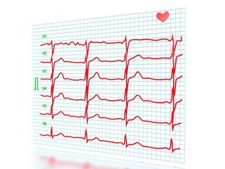 cardiogram on a white background №2