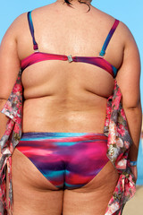 Obesity - Frau mit Übergewicht