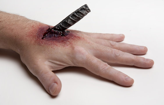 Puncture Wound Images – Browse 2,763 Stock Photos, Vectors, and Video |  Adobe Stock