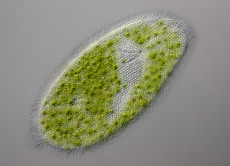 Paramecium bursaria - grünes Pantoffeltierchen - DIC