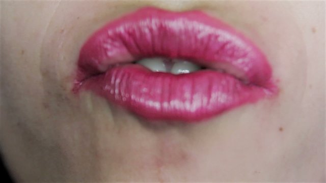 Kiss