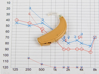 Hearing aid with hearing test in background