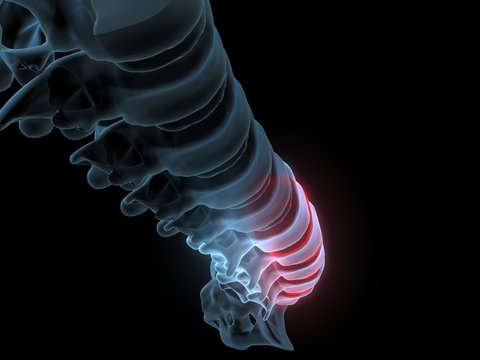 Lendenwirbel perspektive xray