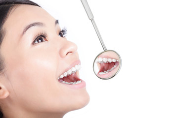 Healthy woman teeth with a dentist mouth mirror