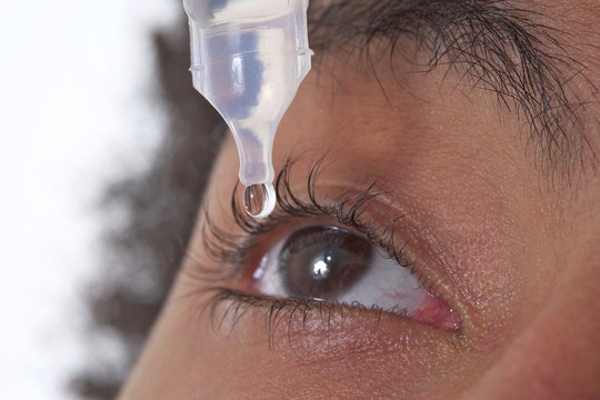 Irritation de l'oeil - Goutte de Collyre