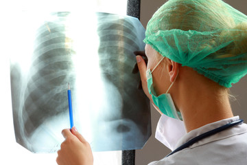 A female doctor examining an x-ray picture