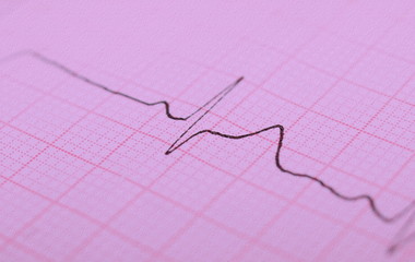 ecg graph, electrocardiogram ekg