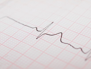 ecg graph, electrocardiogram ekg